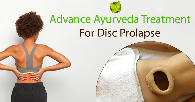 Read more about the article Ayurvedic Treatment For Disc Prolapsed
